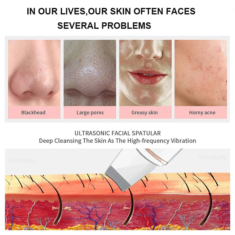 The Gunk Scraper — Ultrasonic Skin Spatula